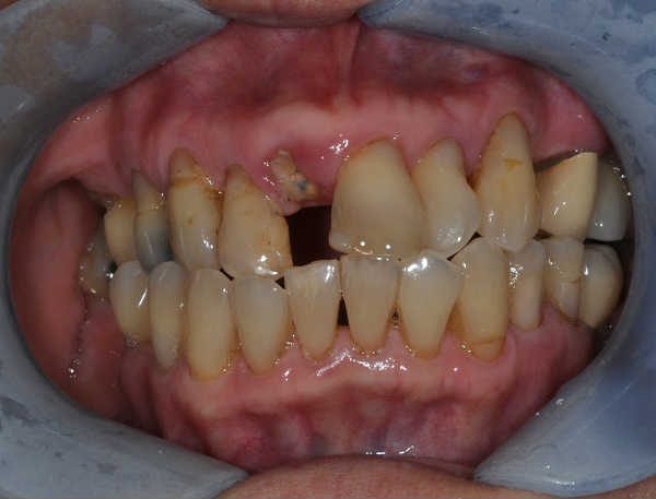 before cosmetic dentistry - Las Vegas, NV