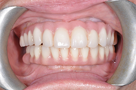 after cosmetic dentistry - Las Vegas, NV