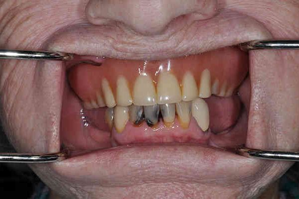 before cosmetic dentistry - Las Vegas, NV