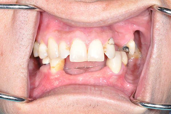 before cosmetic dentistry - Las Vegas, NV