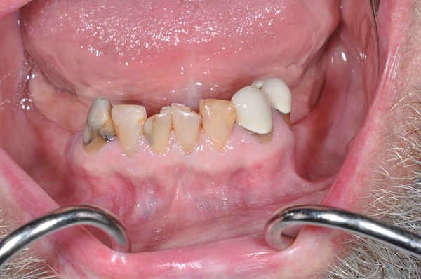 before cosmetic dentistry - Las Vegas, NV